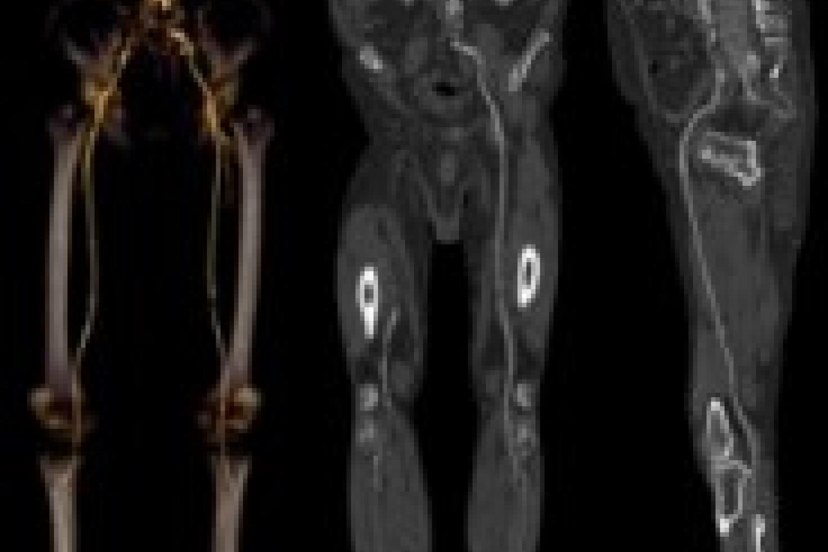 64 Slice CT Scan