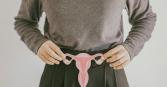 PCOS