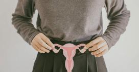 PCOS