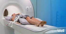 lung cancer screening
